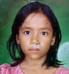 Key Kid Foundation .org, fix Cleft Palate, Fix deformaties, Facial Surgery Project